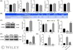 DDOST Antibody in Western Blot (WB)