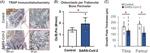 Tartrate Resistant Acid Phosphatase Antibody in Immunohistochemistry (IHC)