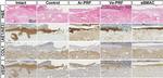 VEGF Antibody in Immunohistochemistry (IHC)