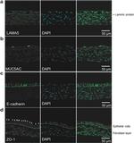 MUC5AC Antibody in Immunohistochemistry (IHC)