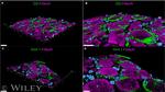 Glutamine Synthetase Antibody in Immunohistochemistry (IHC)