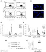 AKT Pan Antibody in Western Blot (WB)