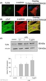 TLR4 Antibody in Western Blot (WB)