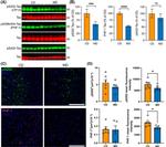 Phospho-Tau (Ser422) Antibody in Western Blot (WB)