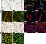 Claudin 10 Antibody in Immunohistochemistry (Paraffin) (IHC (P))