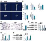 HAPLN1 Antibody in Western Blot (WB)