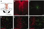 Parvalbumin Antibody in Immunocytochemistry (ICC/IF)