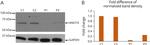 TMEM16K Antibody in Western Blot (WB)