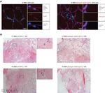 ZNF683 Antibody in Immunohistochemistry (Paraffin) (IHC (P))