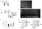 ABCD1 Antibody in Western Blot (WB)