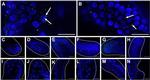 Active/Pro-Caspase 3 Antibody in Immunohistochemistry (Paraffin) (IHC (P))