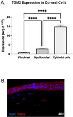 TGM2 Antibody in Immunohistochemistry (Paraffin) (IHC (P))