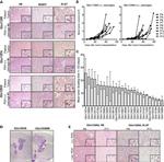 MGMT Antibody in Immunohistochemistry (Paraffin) (IHC (P))