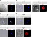 Complement C5 Antibody in Immunocytochemistry (ICC/IF)