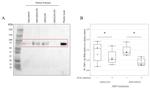 GP6 Antibody in Western Blot (WB)