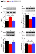 NMDAR2B Antibody in Western Blot (WB)