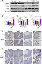 MUC1 Antibody in Immunohistochemistry (Paraffin) (IHC (P))