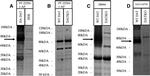 Dopamine Transporter Antibody in Western Blot (WB)