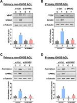 VEGF Antibody in Western Blot (WB)