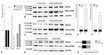 Involucrin Antibody in Western Blot (WB)