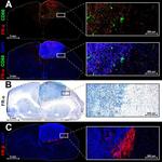 Folate Receptor alpha Antibody in Immunohistochemistry (Frozen) (IHC (F))