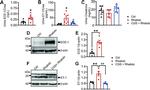 ECE1 Antibody in Western Blot (WB)