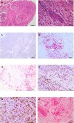 CD4 Antibody in Immunohistochemistry (Paraffin) (IHC (P))