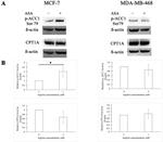 Phospho-Acetyl-CoA Carboxylase (Ser79) Antibody in Western Blot (WB)