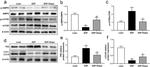 SQSTM1 Antibody in Western Blot (WB)