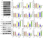 TCF4 Antibody in Western Blot (WB)