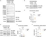 O-linked N-acetylglucosamine (O-GlcNAc) Antibody in Western Blot (WB)