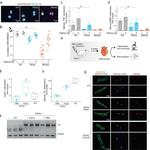 Rbm20 Antibody in Immunocytochemistry (ICC/IF)