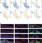 CRIP1 Antibody in Immunohistochemistry (Paraffin) (IHC (P))