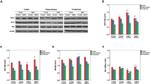 Bcl-2 Antibody in Western Blot (WB)