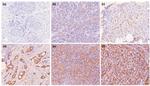 Calcium Sensing Receptor Antibody in Immunohistochemistry (Paraffin) (IHC (P))