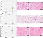 RIG-I Antibody in Immunohistochemistry (Paraffin) (IHC (P))