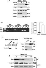 PTCH2 Antibody in Western Blot (WB)