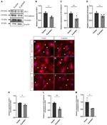 Occludin Antibody in Immunocytochemistry (ICC/IF)