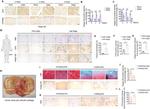 CD61 (Integrin beta 3) Antibody in Immunohistochemistry (Paraffin) (IHC (P))