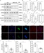 Cyclin D1 Antibody in Western Blot (WB)