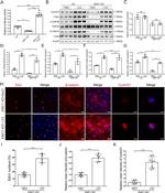 Cyclin D1 Antibody in Western Blot (WB)