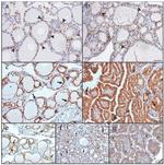 Furin Antibody in Immunohistochemistry (IHC)