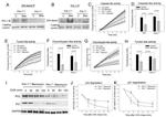 PAI1 Antibody in Western Blot, Immunoprecipitation (WB, IP)