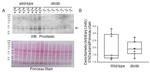 Prostasin Antibody in Western Blot (WB)