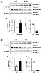 Nkx2.1 Antibody in Immunoprecipitation (IP)