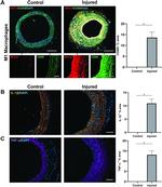 IL-1 beta Antibody in Immunohistochemistry (Paraffin) (IHC (P))