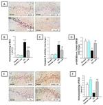 Bcl-2 Antibody in Immunohistochemistry (Paraffin) (IHC (P))