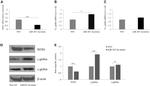 Hemoglobin gamma A Antibody in Western Blot (WB)