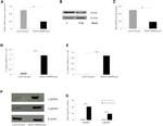 Hemoglobin gamma A Antibody in Western Blot (WB)