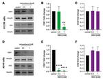 CK2 alpha-2 Antibody in Western Blot (WB)